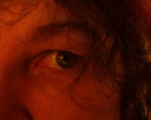 myeyeball